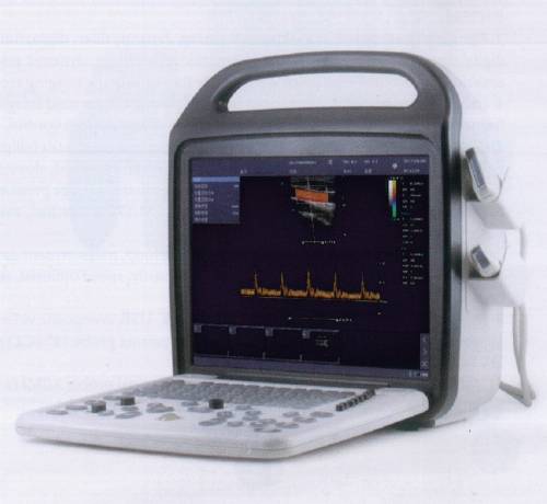 Full Digital Color Doppler Ultrasound Scanner 