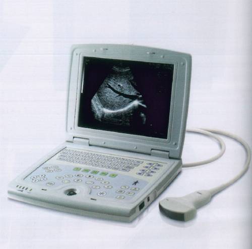 B Mode Ultrasound Machine 